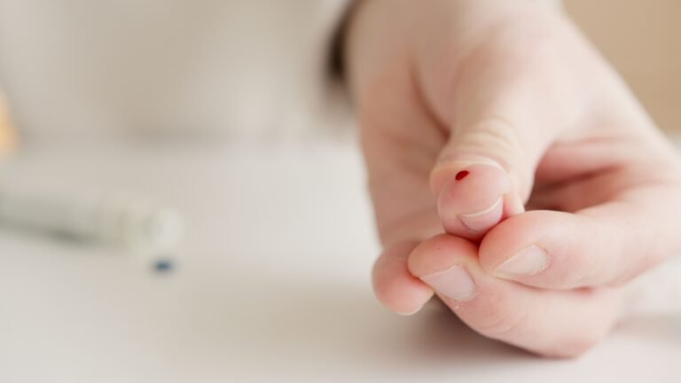Dedo em gatilho: entenda por que o dedo trava ao dobrar