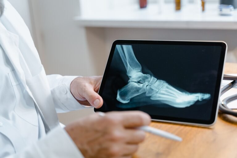 Luxação articular: o que acontece quando o osso sai do lugar